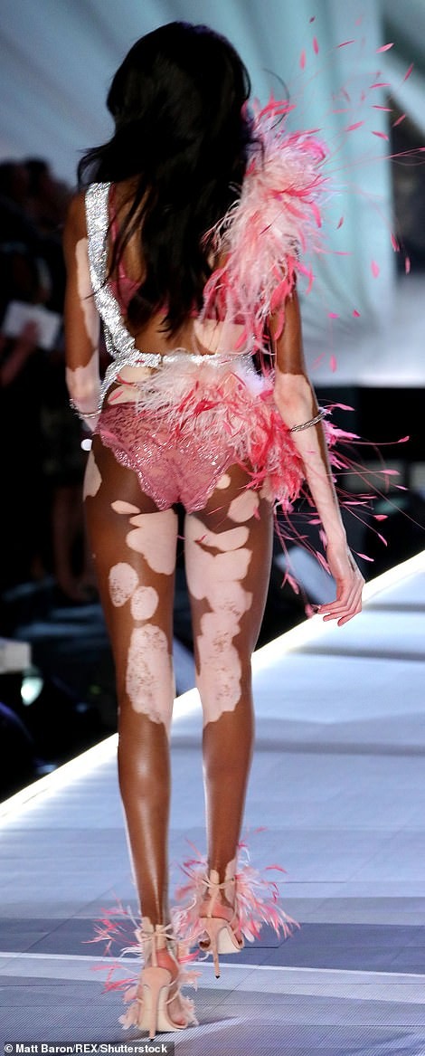 Winnie Harlow makes history as first model with vitiligo to walk the runway at Victoria