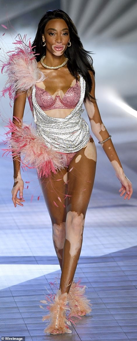 Winnie Harlow makes history as first model with vitiligo to walk the runway at Victoria