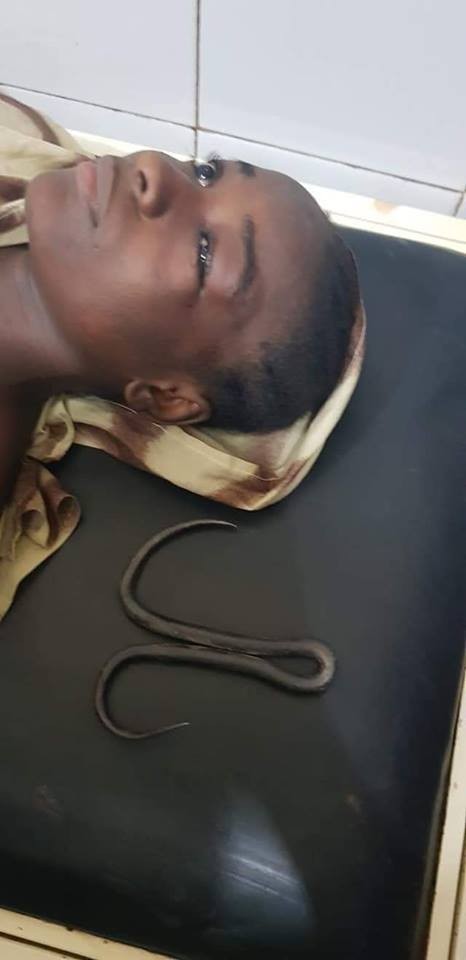 Doctors rescue little girl after Iron hook passed through her eyes (graphic photos)