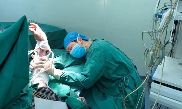 Surgeon falls asleep on operating table after performing six surgeries without taking a break
