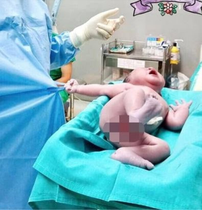 Newborn baby grabs doctor