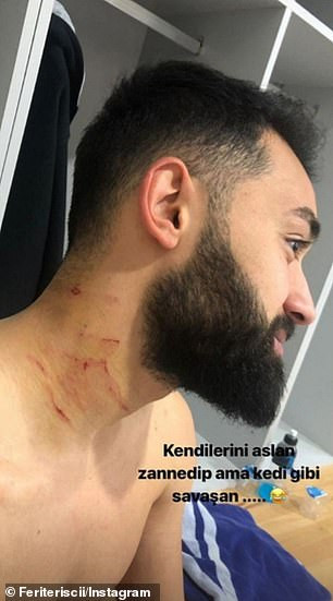 Football player is caught using a razor blade to attack opponents on the field as his victims show off scars on social media (Photos/Video)