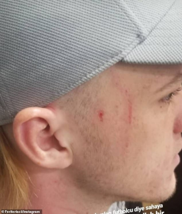 Football player is caught using a razor blade to attack opponents on the field as his victims show off scars on social media (Photos/Video)