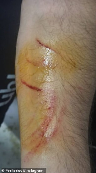 Football player is caught using a razor blade to attack opponents on the field as his victims show off scars on social media (Photos/Video)