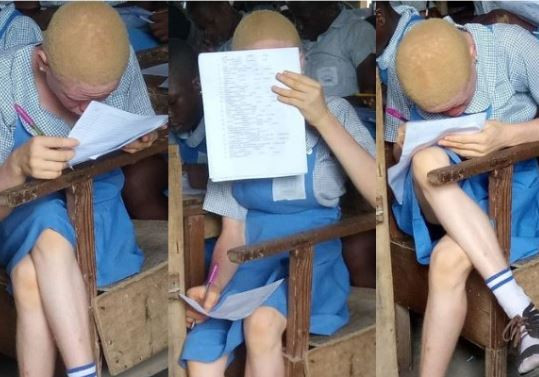 Youth corper seeks help for her female albino student who has issues with her eyesight
