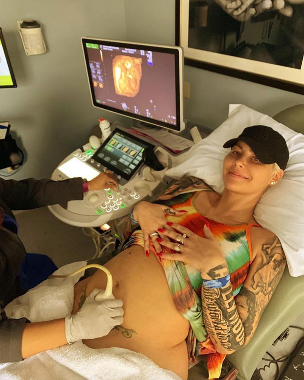 Amber Rose is expecting her second child with boyfriend Alexander