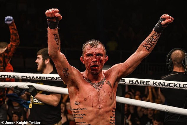 Bare-knuckle boxing: Opponents show off the gruesome injuries they incurred on their faces (Photos)