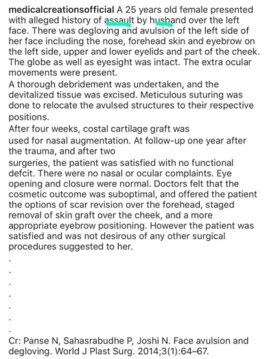 Doctors reconstruct the face of a woman after it was torn by her husband and it