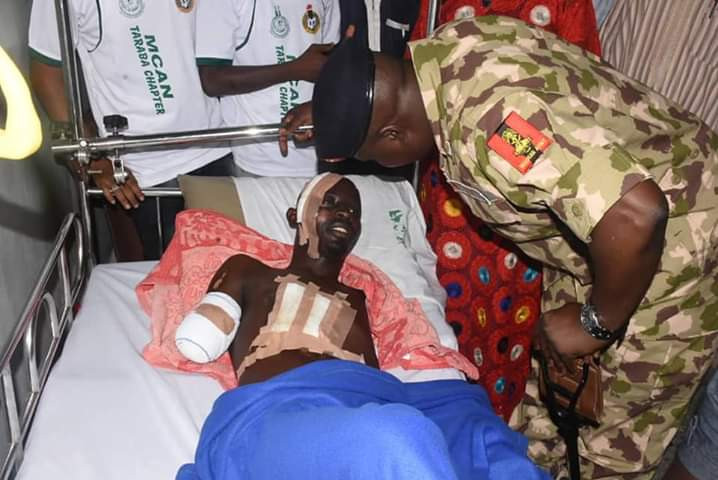 Photos: Corps member who lost both arms in ghastly auto crash to get automatic job, artificial limbs - NYSC DG