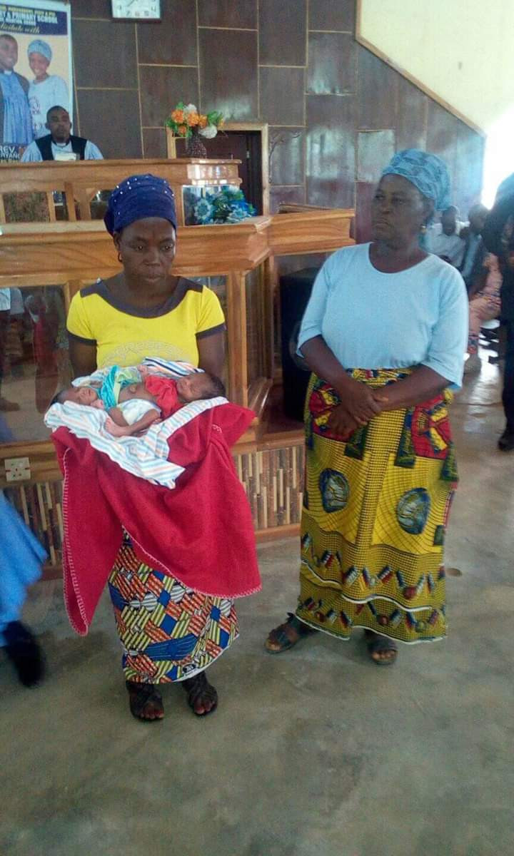 Photos: Woman gives birth to conjoined twins in Benue