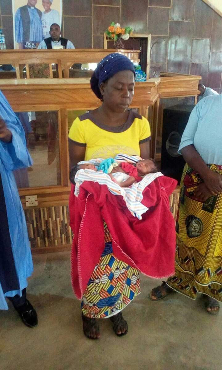Photos: Woman gives birth to conjoined twins in Benue