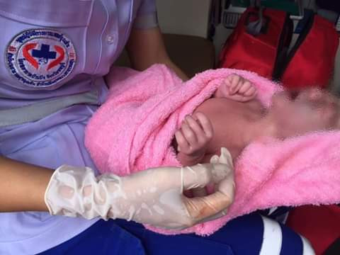  Photos: Woman gives birth to baby girl with 12 fingers and 12 toes