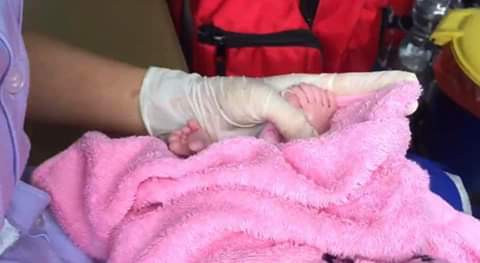  Photos: Woman gives birth to baby girl with 12 fingers and 12 toes