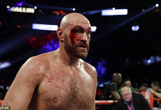 See more photos of the injury Tyson Fury suffered as he