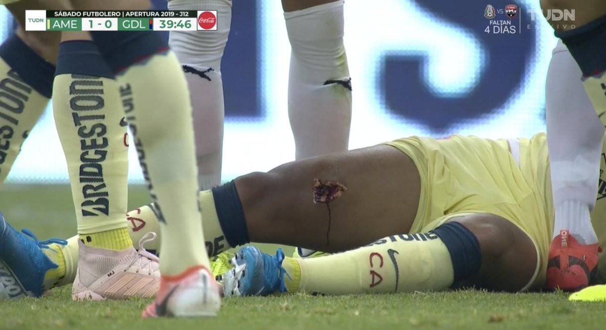 Ex-Barcelona star Giovani dos Santos suffers gruesome injury as his leg is torn open in horrible challenge (Photos)