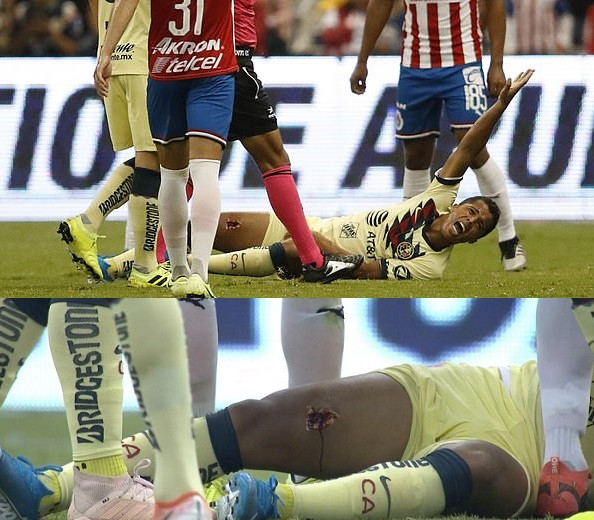 Ex-Barcelona star Giovani dos Santos suffers gruesome injury as his leg is torn open in horrible challenge (Photos)