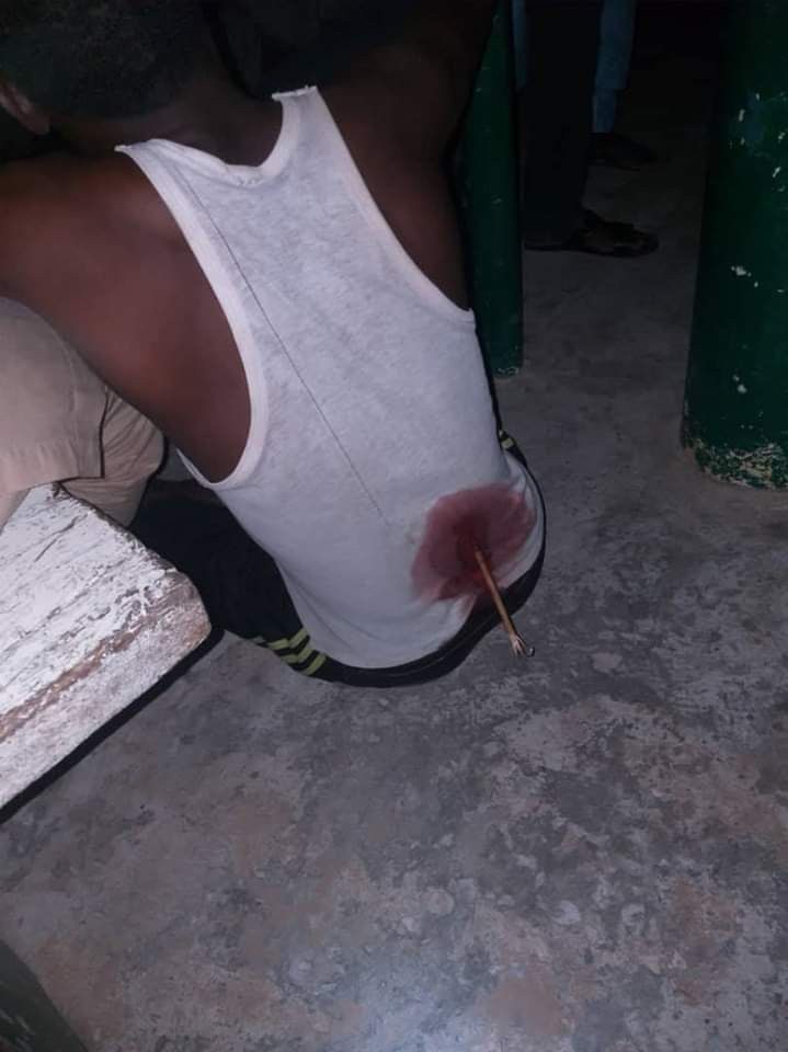  Shocking photos show doctor operating on seriously injured patient under torchlight in Jigawa State