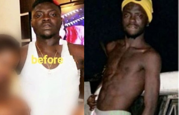 Nigerian Porn Star, Kingtblakhoc shares his before and after photos but fans think he is sick ( see photos)