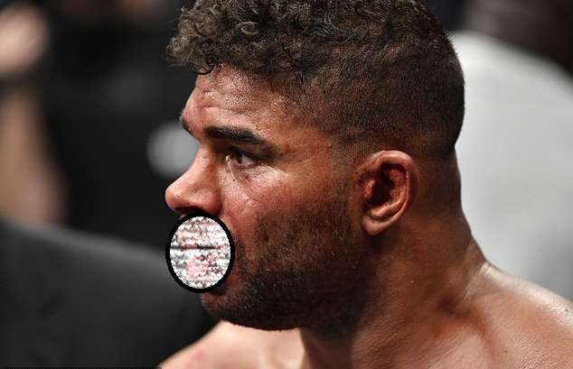 UFC star Alistair Overeem