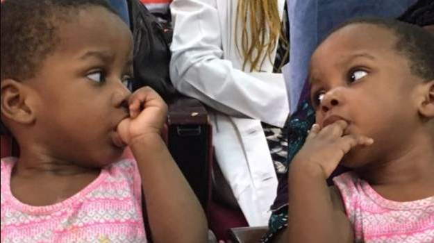 Nigerian doctors separate conjoined twins (photos)