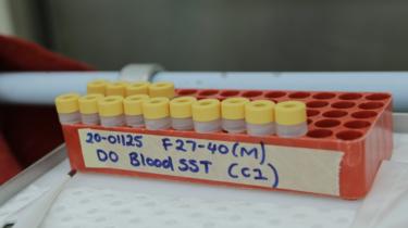 Vials of the potential vaccines for coronavirus