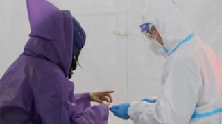 antibody test in New York