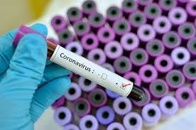 Nigerian man on the run after testing positive for Coronavirus in Ghana