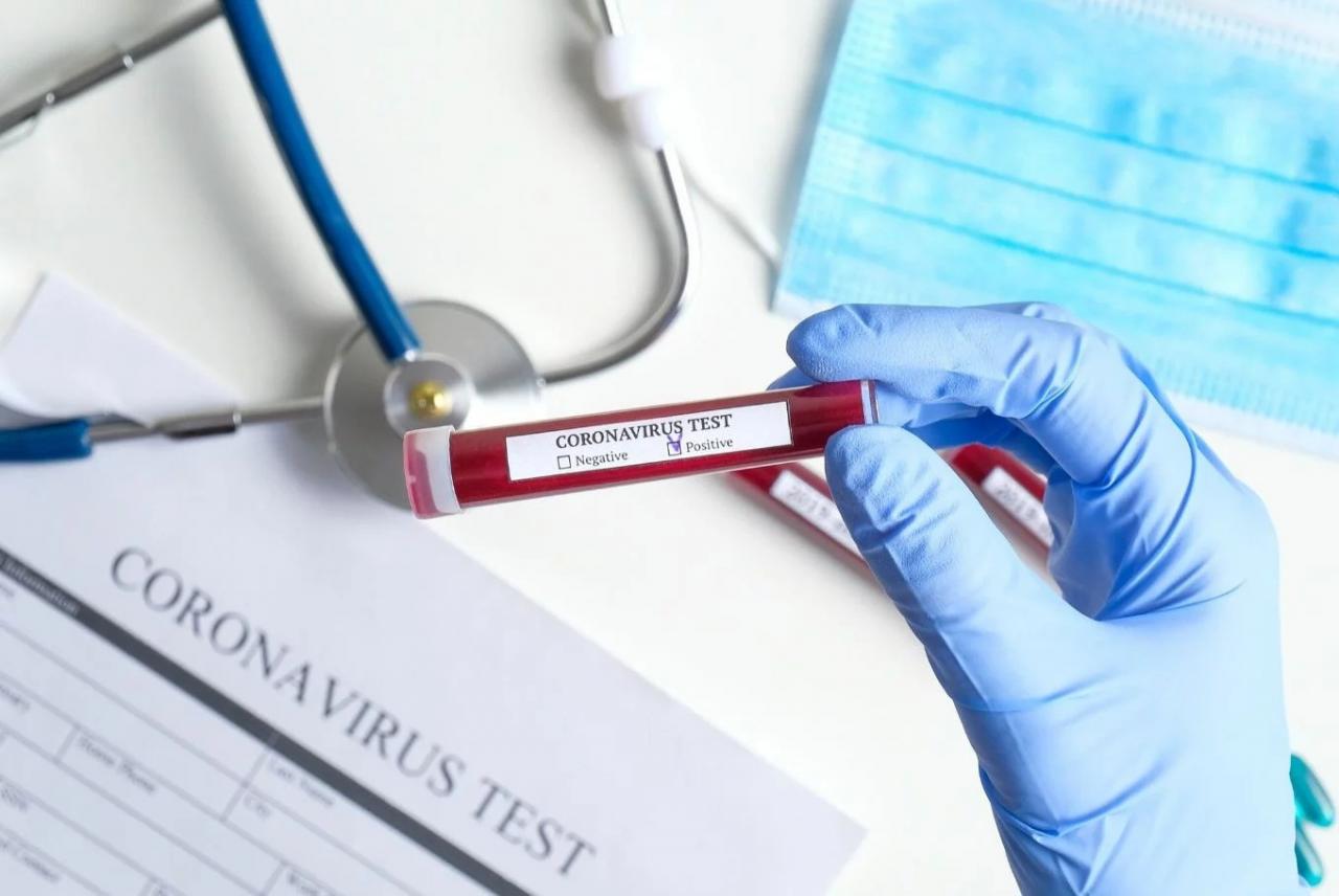 Three COVID-19 patients discharged in Kaduna