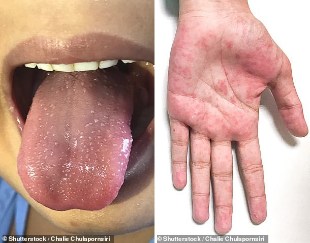 NHS issues urgent alert as children are being admitted to intensive care with a new Coronavirus-related