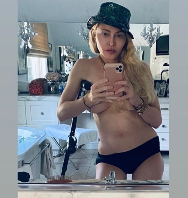 Madonna, 61, flaunts her perky boobs as she leans on a crutch
