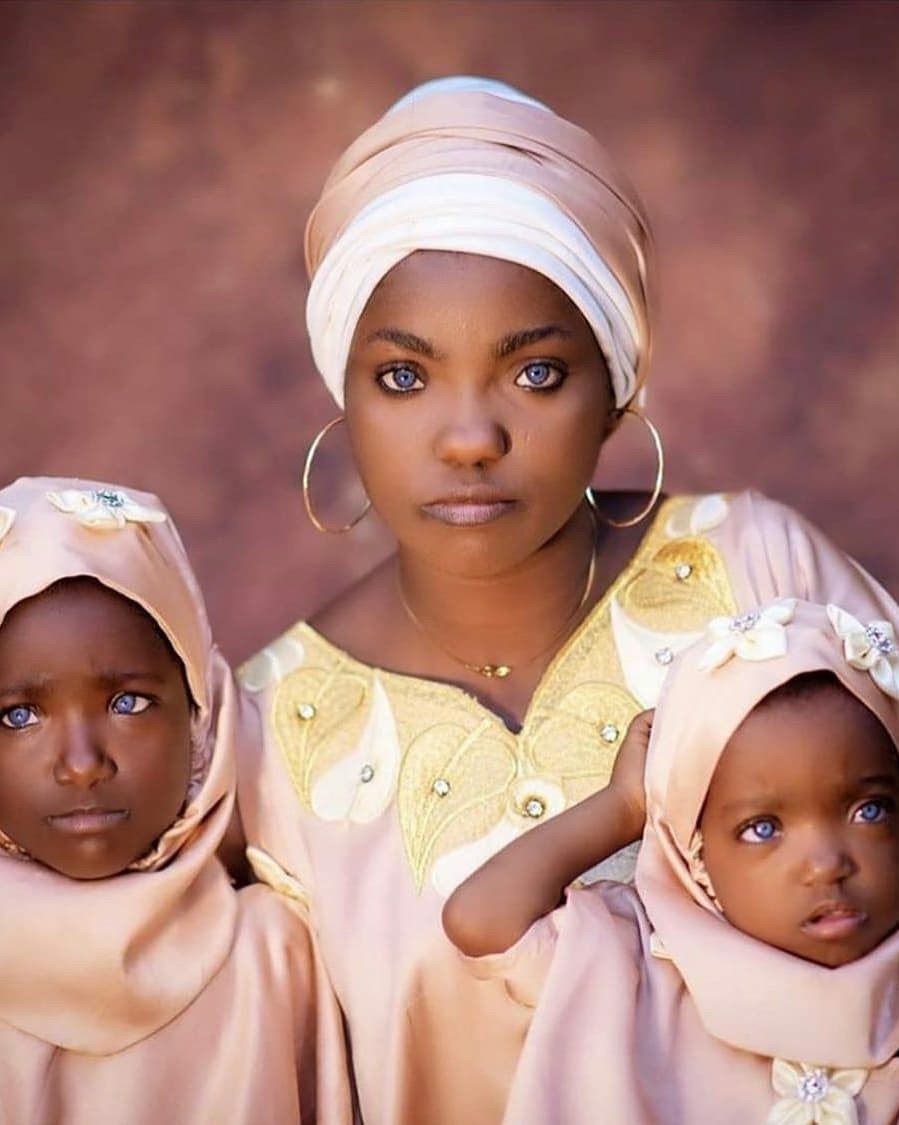 Blue-eyed Kwara woman makes peace with her husband as they team up for a lovely photo shoot