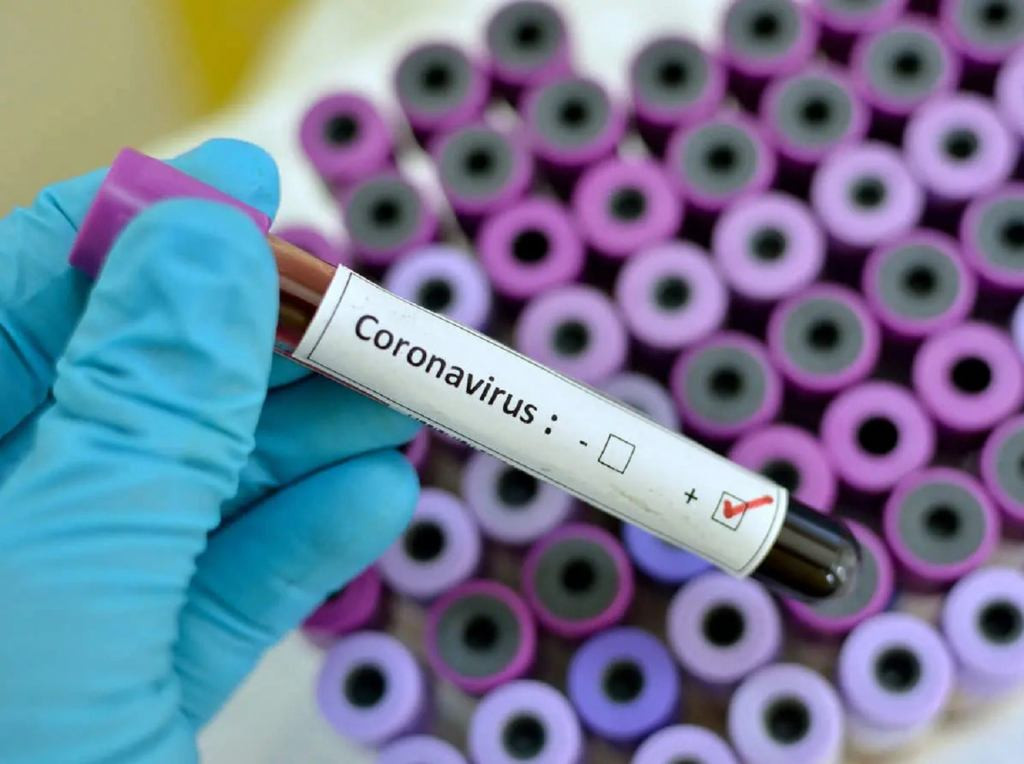 Coronavirus cases is dropping due to low testing - PTF