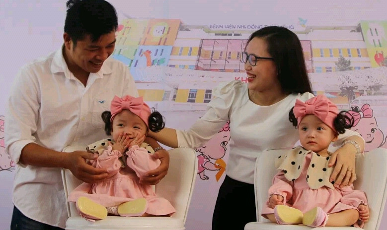 Conjoined twins discharged from hospital after successful separation