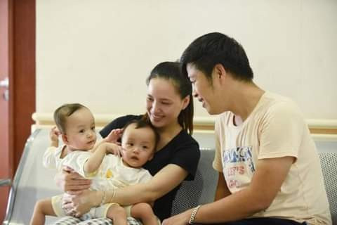 Conjoined twins discharged from hospital after successful separation