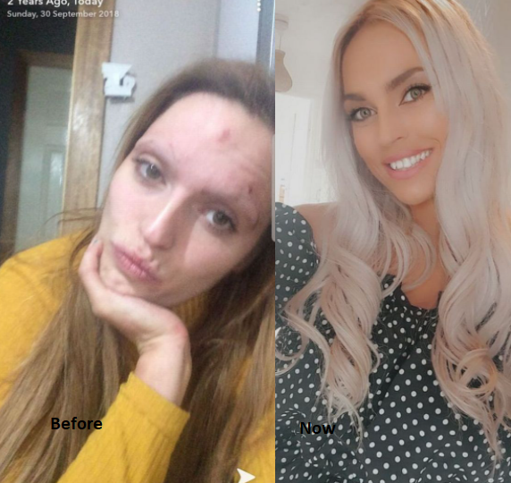 Former drug addict shares incredible before and after photos after she changed her lifestyle