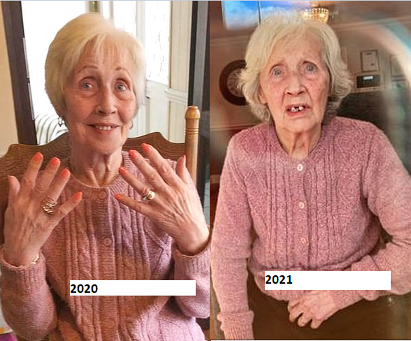 Before and after photos show the effect one year of loneliness had on elderly people following months of lockdown