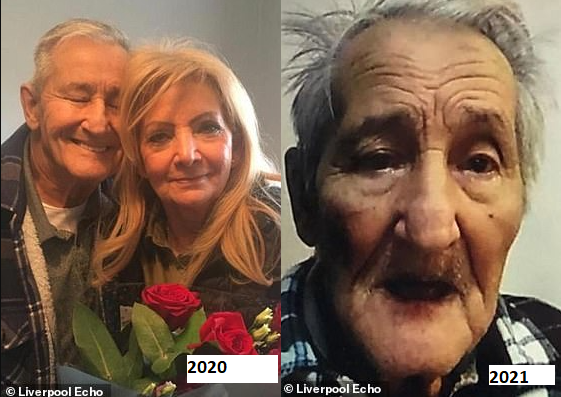 Before and after photos show the effect one year of loneliness had on elderly people following months of lockdown