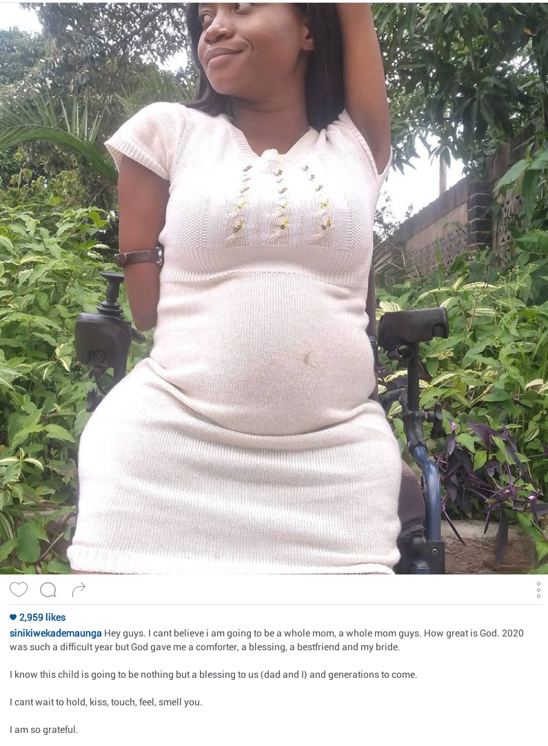 Zimbabwean motivational speaker born without limbs reveals she is pregnant, shares baby bump photos 