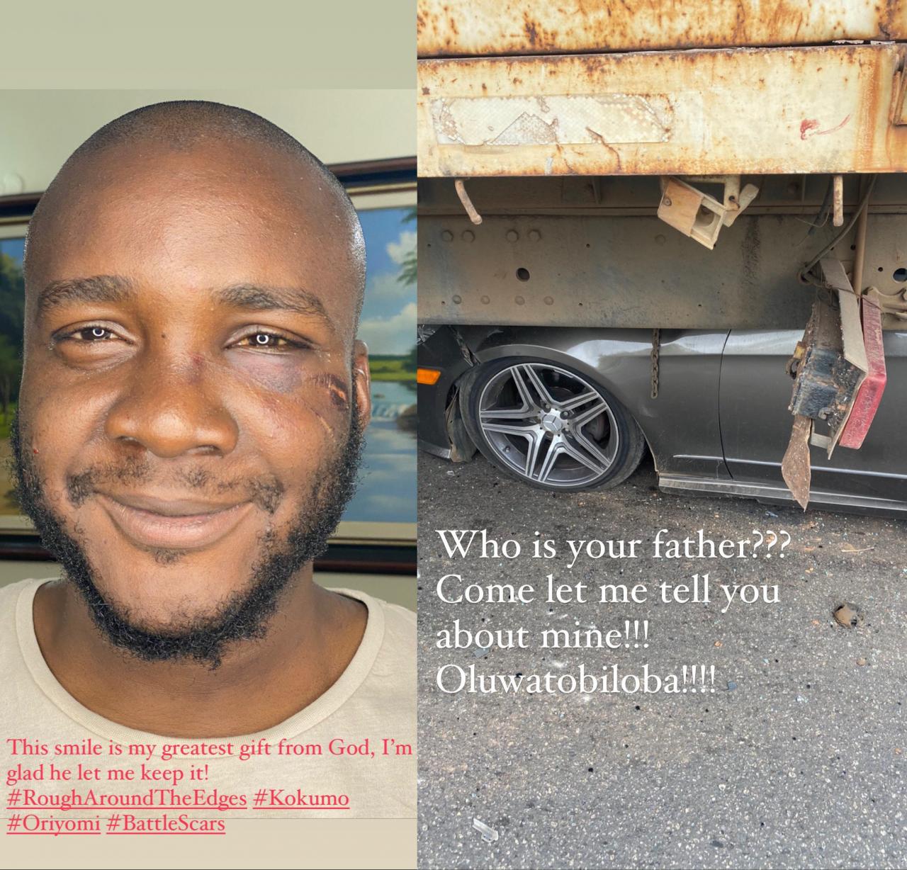 "Someone survived this?" Shock as man shares testimony of how he survived car accident