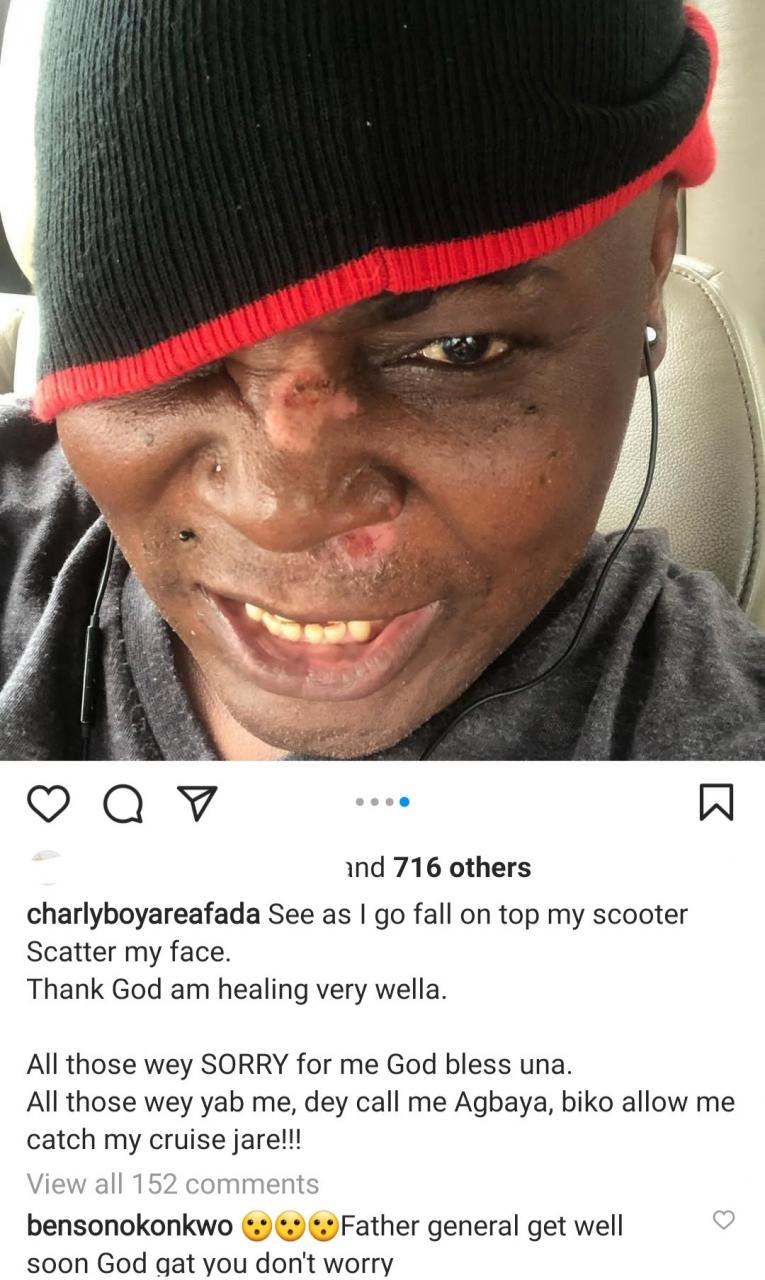 Charly Boy sustains minor injuries on face after falling on his scooter 