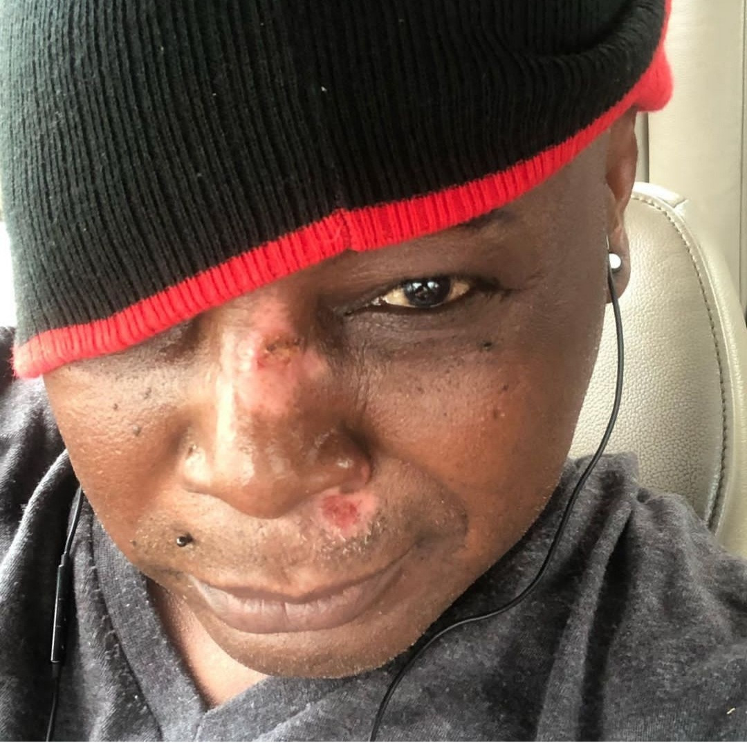 Charly Boy sustains minor injuries on face after falling on his scooter 