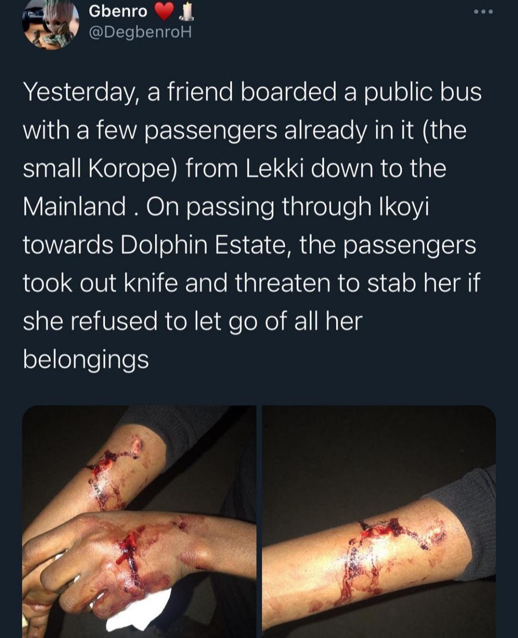 Nurse allegedly robbed and stabbed on bus by one-chance operators in Lagos 