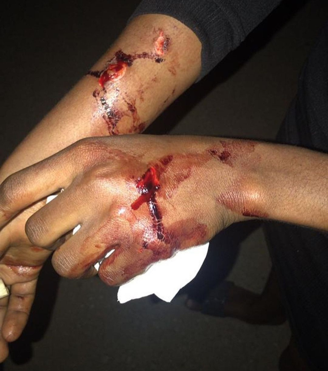 Nurse allegedly robbed and stabbed on bus by one-chance operators in Lagos 