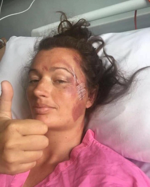 Woman miraculously survives after falling 60ft off cliff edge and landing on rocks