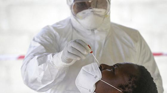 COVID-19 infection rose by 77 per cent in one week - NCDC reports