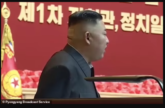 North Korean leader, Kim Jong Un?spotted with plaster on the back of his head and mysterious black spots?in latest health scare (photos)