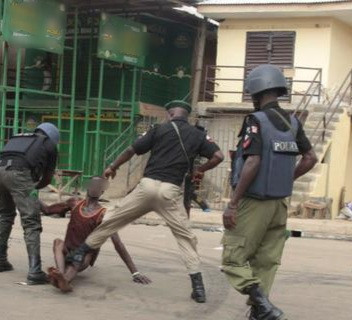 Man docked for biting off police officer