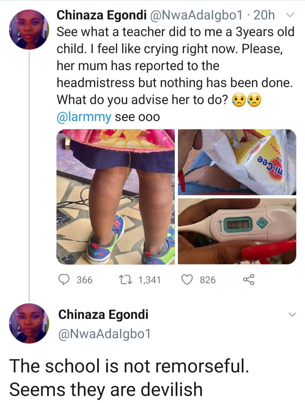 3-year-old pupil left badly bruised after she was flogged by teacher