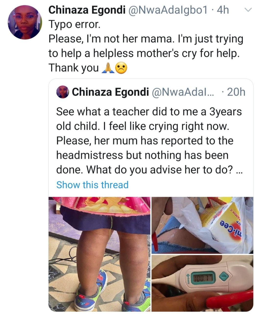 3-year-old pupil left badly bruised after she was flogged by teacher