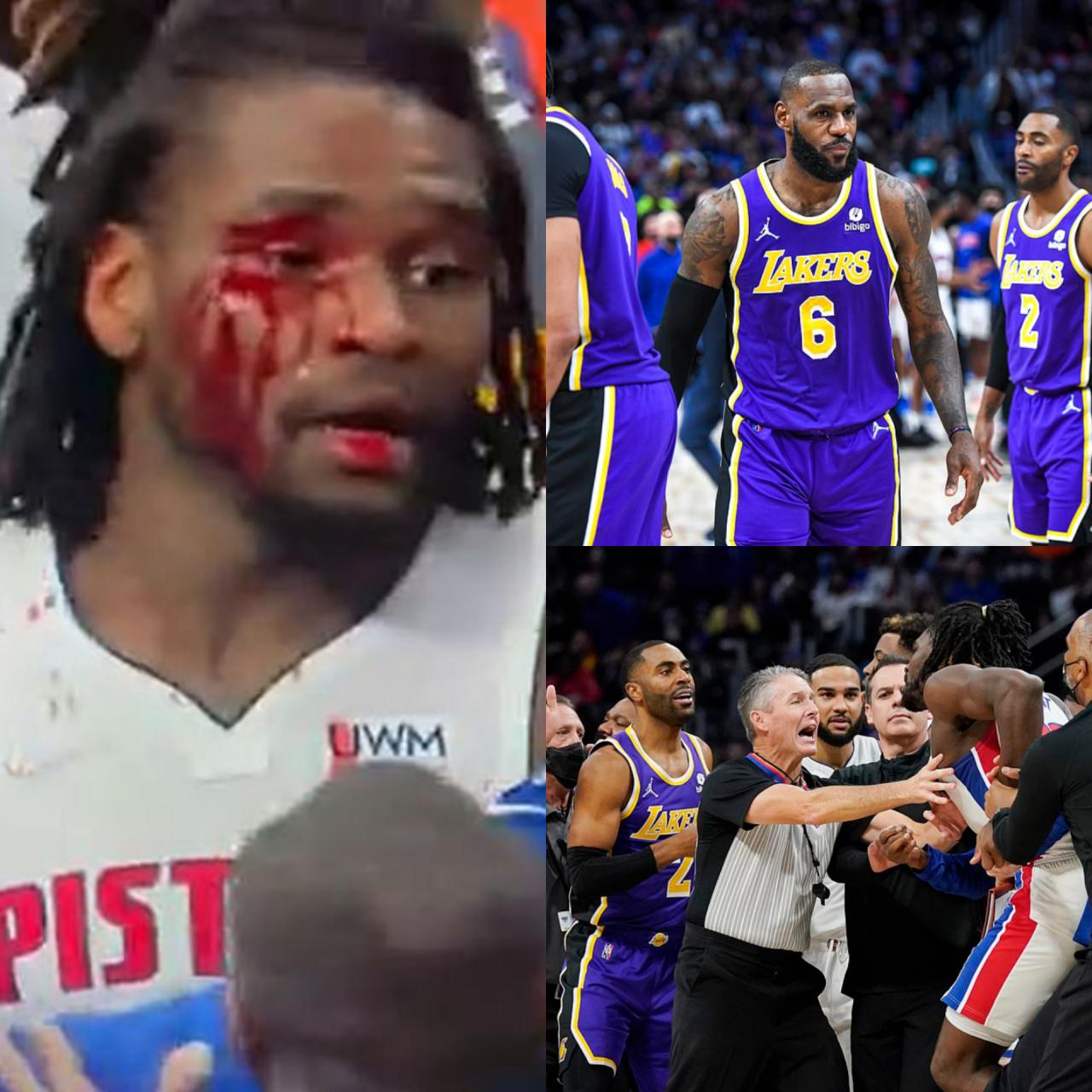 20 man fight erupts as LeBron James is ejected for giving shocking elbow to face of Isaiah Stewart during NBA game(Photos/Videos)
